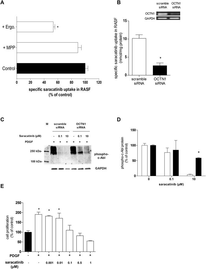 https://cdn.ncbi.nlm.nih.gov/pmc/blobs/26cb/5430895/7dadcfc295f9/41598_2017_1438_Fig3_HTML.jpg