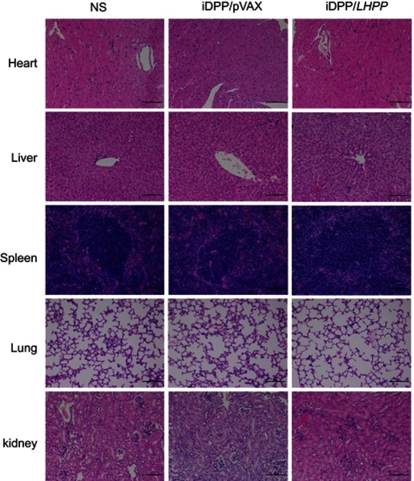 https://cdn.ncbi.nlm.nih.gov/pmc/blobs/26cc/6516749/09283e1a586c/IJN-14-3455-g0005.jpg