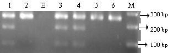 https://cdn.ncbi.nlm.nih.gov/pmc/blobs/26d4/2656464/9623256e3404/1475-2840-8-11-5.jpg