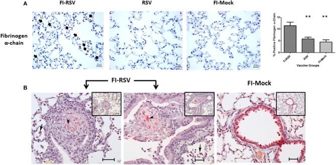 https://cdn.ncbi.nlm.nih.gov/pmc/blobs/26e2/6449435/78de0b89d6be/fimmu-10-00597-g0007.jpg