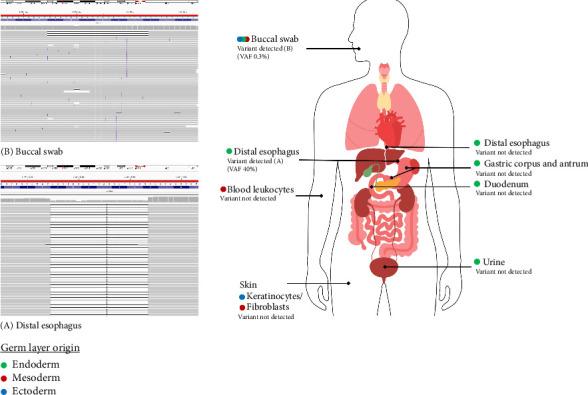https://cdn.ncbi.nlm.nih.gov/pmc/blobs/26e5/12411021/5ec9b4eebf6c/CRIG2025-6261903.001.jpg