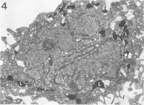 https://cdn.ncbi.nlm.nih.gov/pmc/blobs/26ec/415335/363fdd49d83d/iai00237-0192-b.jpg