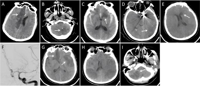 https://cdn.ncbi.nlm.nih.gov/pmc/blobs/26ed/12048411/867596090507/10143_2025_3557_Fig4_HTML.jpg