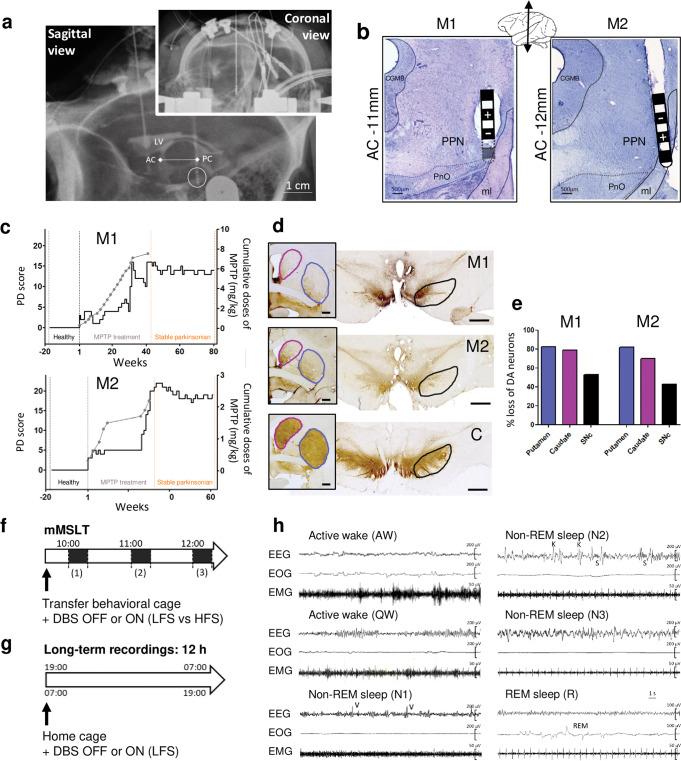 https://cdn.ncbi.nlm.nih.gov/pmc/blobs/26ed/9876933/392f278b4efe/41531_2023_455_Fig1_HTML.jpg