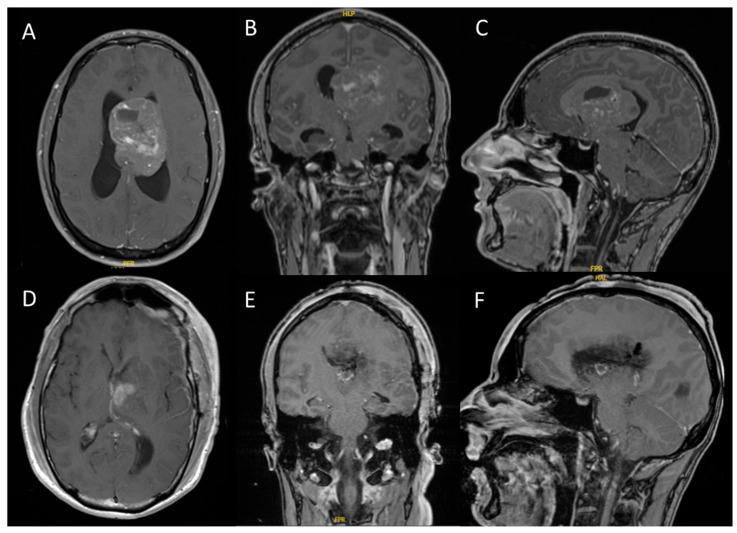 https://cdn.ncbi.nlm.nih.gov/pmc/blobs/26f3/12190501/4dbe8e36c97f/cancers-17-02005-g001.jpg