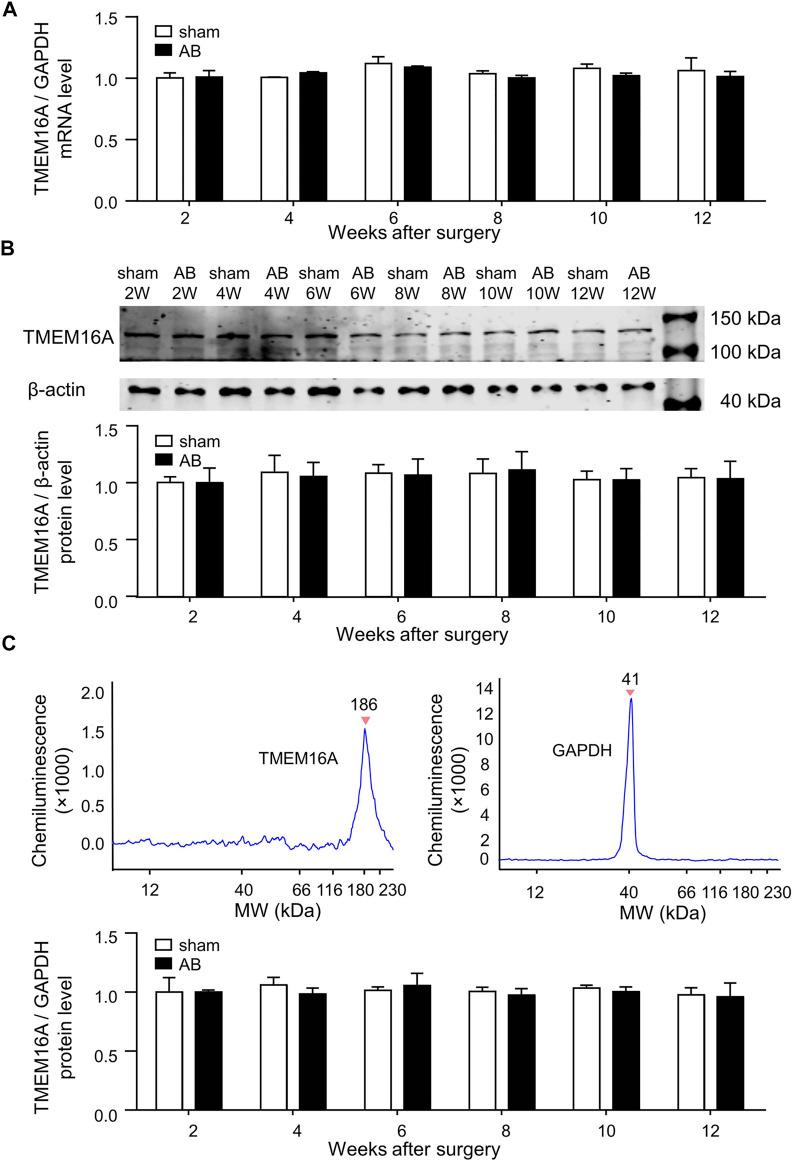 https://cdn.ncbi.nlm.nih.gov/pmc/blobs/26f5/9194855/07a679c11a36/fphys-13-897619-g001.jpg