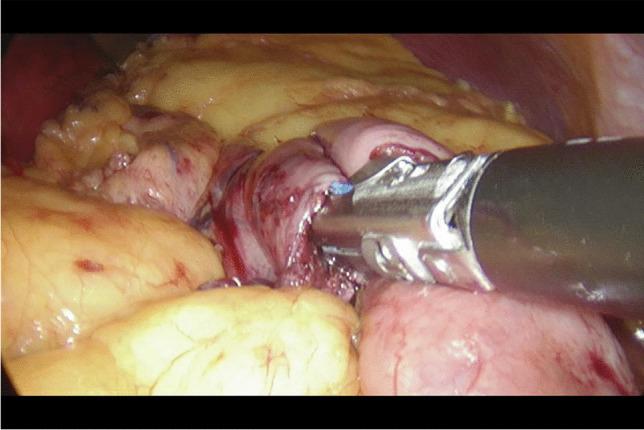 https://cdn.ncbi.nlm.nih.gov/pmc/blobs/26f5/9922227/1a4cb3410af5/423_2023_2785_Fig6_HTML.jpg