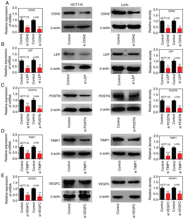 https://cdn.ncbi.nlm.nih.gov/pmc/blobs/26fd/8343572/86b1c48e8e59/etm-22-03-10455-g05.jpg