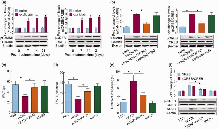 https://cdn.ncbi.nlm.nih.gov/pmc/blobs/2704/5974562/245157bf1160/10.1177_1744806918778490-fig4.jpg