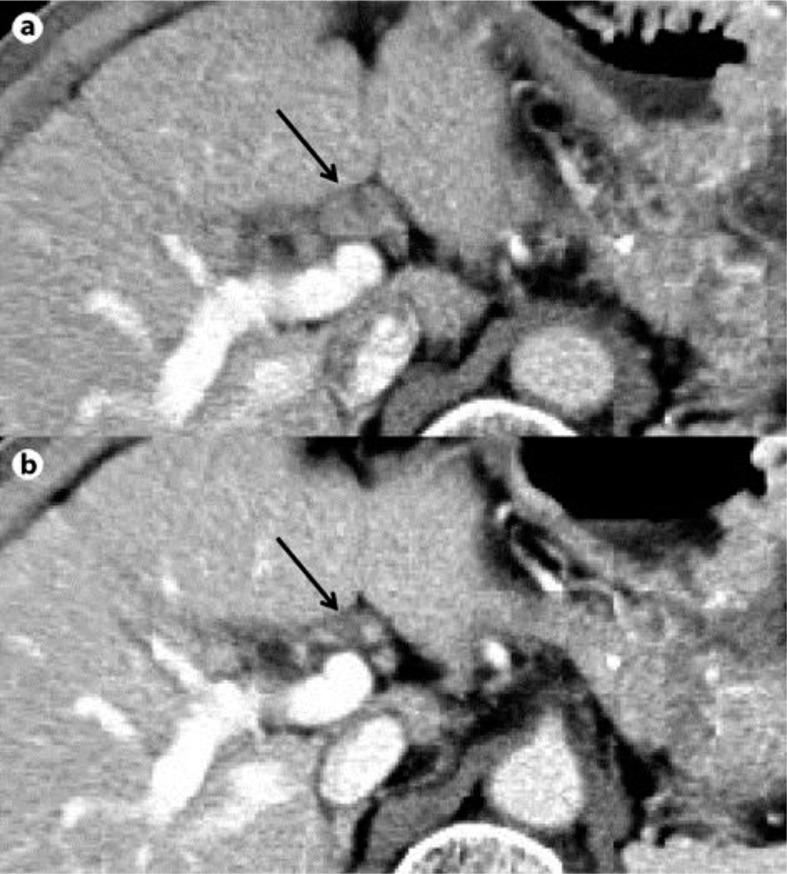 https://cdn.ncbi.nlm.nih.gov/pmc/blobs/2707/3409511/13c14d7bc999/cro-0005-0380-g02.jpg