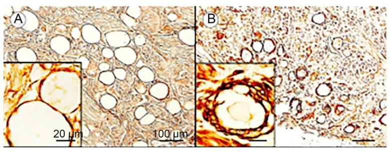 https://cdn.ncbi.nlm.nih.gov/pmc/blobs/2709/11011452/a278463ddff2/cells-13-00566-g006.jpg
