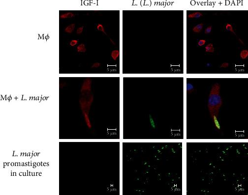 https://cdn.ncbi.nlm.nih.gov/pmc/blobs/270a/8116165/eba78803d1ff/JIR2021-6614475.004.jpg