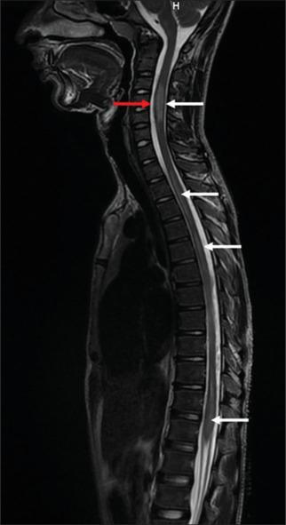 https://cdn.ncbi.nlm.nih.gov/pmc/blobs/270b/11556487/878788ba0bc0/AAM-23-731-g003.jpg