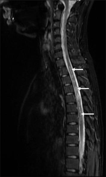 https://cdn.ncbi.nlm.nih.gov/pmc/blobs/270b/11556487/f838f628514d/AAM-23-731-g002.jpg
