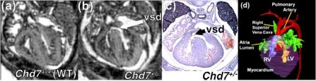 https://cdn.ncbi.nlm.nih.gov/pmc/blobs/270f/3040459/445f6a66fdac/TOCMJ-4-278_F13.jpg