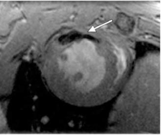 https://cdn.ncbi.nlm.nih.gov/pmc/blobs/270f/3040459/6064b226482a/TOCMJ-4-278_F10.jpg