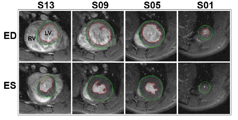 https://cdn.ncbi.nlm.nih.gov/pmc/blobs/270f/3040459/81a982a40507/TOCMJ-4-278_F2.jpg