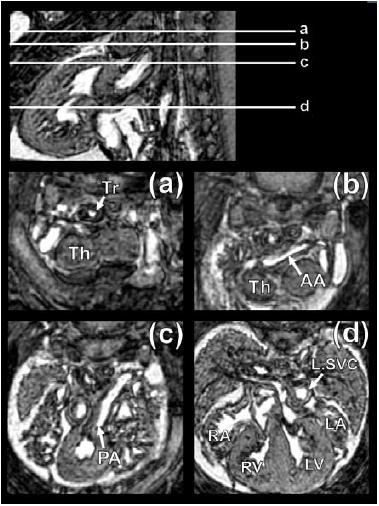 https://cdn.ncbi.nlm.nih.gov/pmc/blobs/270f/3040459/91ef9dda57dd/TOCMJ-4-278_F12.jpg
