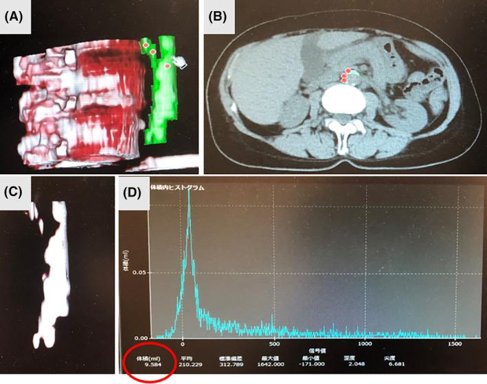 https://cdn.ncbi.nlm.nih.gov/pmc/blobs/2713/11693558/0ce3b95938ba/AGS3-9-169-g003.jpg