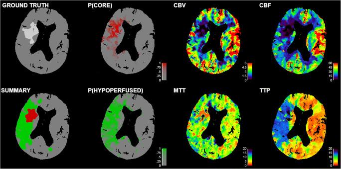 https://cdn.ncbi.nlm.nih.gov/pmc/blobs/2714/9381605/50ac209fb769/330_2022_8700_Fig1_HTML.jpg