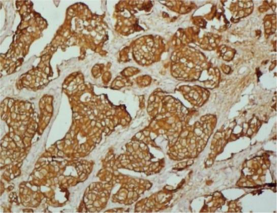 https://cdn.ncbi.nlm.nih.gov/pmc/blobs/271c/10898916/69d470bb381b/can-17-1607fig1.jpg