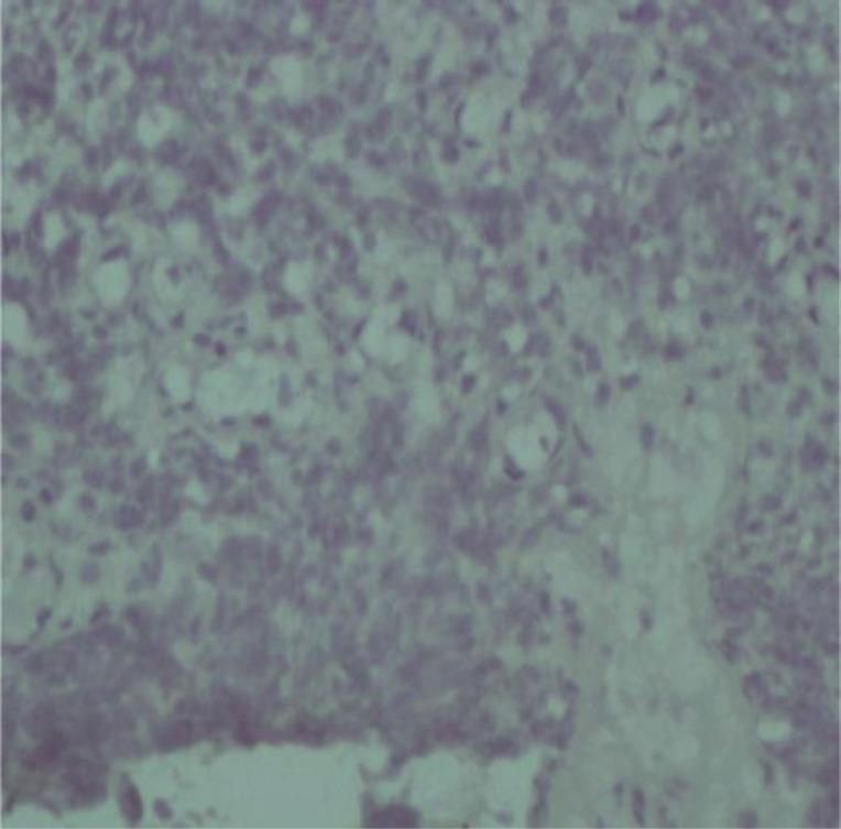 https://cdn.ncbi.nlm.nih.gov/pmc/blobs/271c/10898916/f50daeffbe8b/can-17-1607fig2.jpg