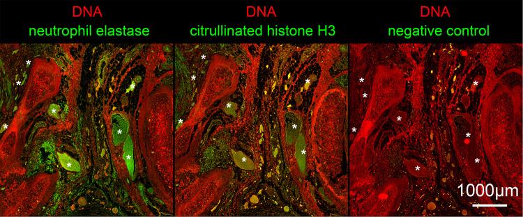 https://cdn.ncbi.nlm.nih.gov/pmc/blobs/271e/9177750/8e465c7ff31a/41418_2022_1015_Fig2_HTML.jpg