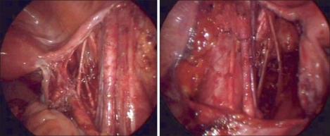 https://cdn.ncbi.nlm.nih.gov/pmc/blobs/2726/3152753/7855c9eb4c41/jgo-22-127-g003.jpg