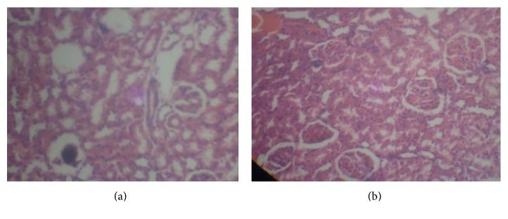 https://cdn.ncbi.nlm.nih.gov/pmc/blobs/272a/4897306/8c9e62d7c4d8/ISRN2014-984709.005.jpg