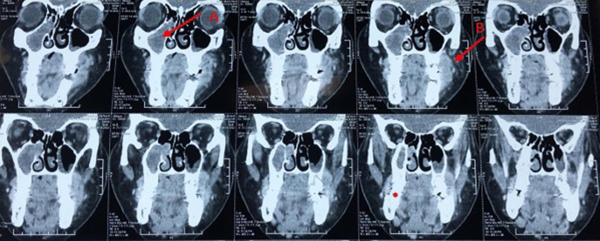 https://cdn.ncbi.nlm.nih.gov/pmc/blobs/272c/11658111/3eb606418e53/13256_2024_4728_Fig5_HTML.jpg