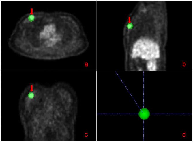 https://cdn.ncbi.nlm.nih.gov/pmc/blobs/272f/11161959/710b95cfce4f/12885_2024_12476_Fig3_HTML.jpg