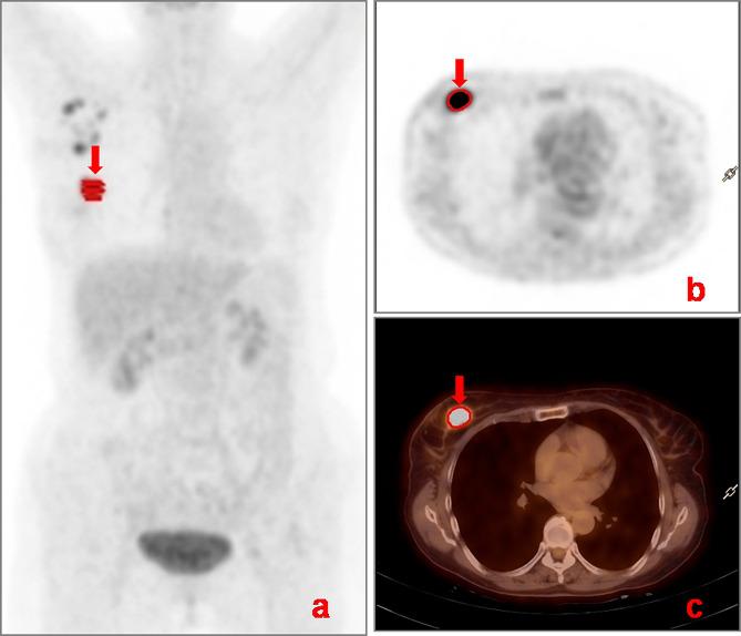 https://cdn.ncbi.nlm.nih.gov/pmc/blobs/272f/11161959/c01d399dbd2b/12885_2024_12476_Fig2_HTML.jpg