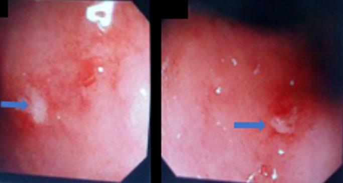 https://cdn.ncbi.nlm.nih.gov/pmc/blobs/2733/7881921/ca4c7a1e23c3/PAMJ-37-298-g004.jpg