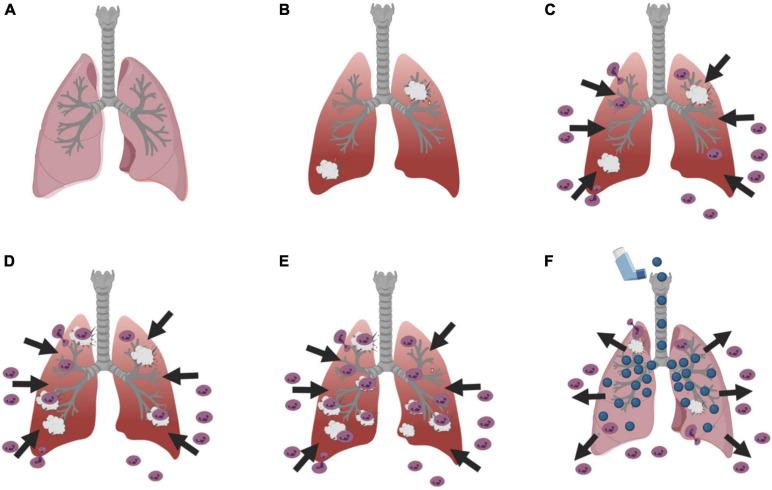 https://cdn.ncbi.nlm.nih.gov/pmc/blobs/2737/8326840/5f0fb0df2572/fcell-09-710005-g001.jpg