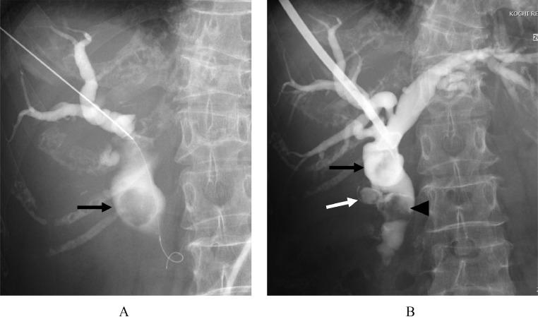 https://cdn.ncbi.nlm.nih.gov/pmc/blobs/273b/9619335/caa16226faac/gr3.jpg