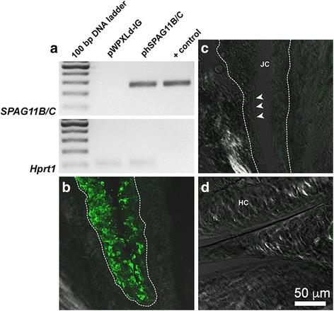 https://cdn.ncbi.nlm.nih.gov/pmc/blobs/273d/5461776/576017a4be8a/13075_2017_1326_Fig2_HTML.jpg