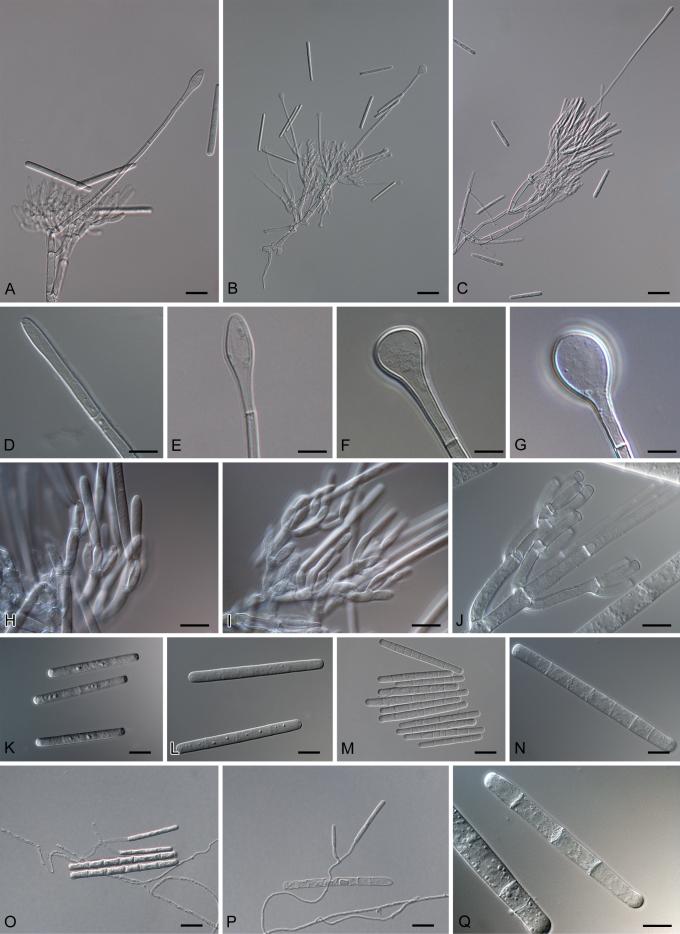 https://cdn.ncbi.nlm.nih.gov/pmc/blobs/274d/2886097/126205f6832c/1fig3.jpg