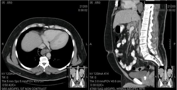 https://cdn.ncbi.nlm.nih.gov/pmc/blobs/2751/3184047/8b34e47fc6e3/1749-8090-6-113-1.jpg