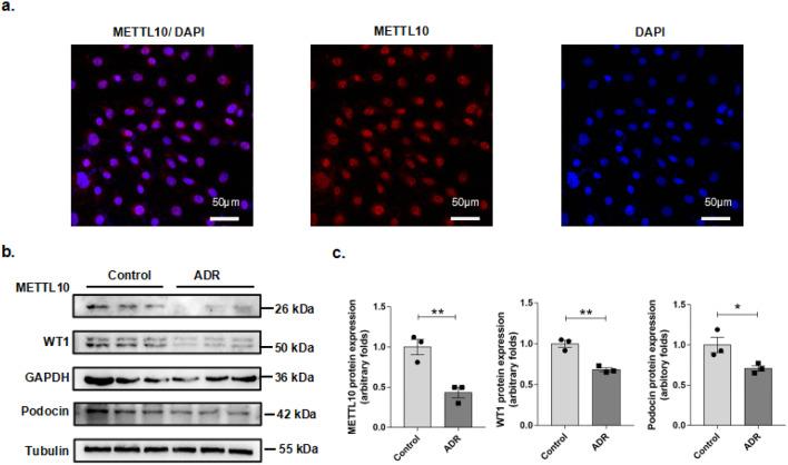 https://cdn.ncbi.nlm.nih.gov/pmc/blobs/2752/11707283/ee0744628b22/41598_2024_80526_Fig3_HTML.jpg