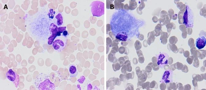 https://cdn.ncbi.nlm.nih.gov/pmc/blobs/2755/6656677/8019fc9d0b02/WJCC-7-1475-g001.jpg