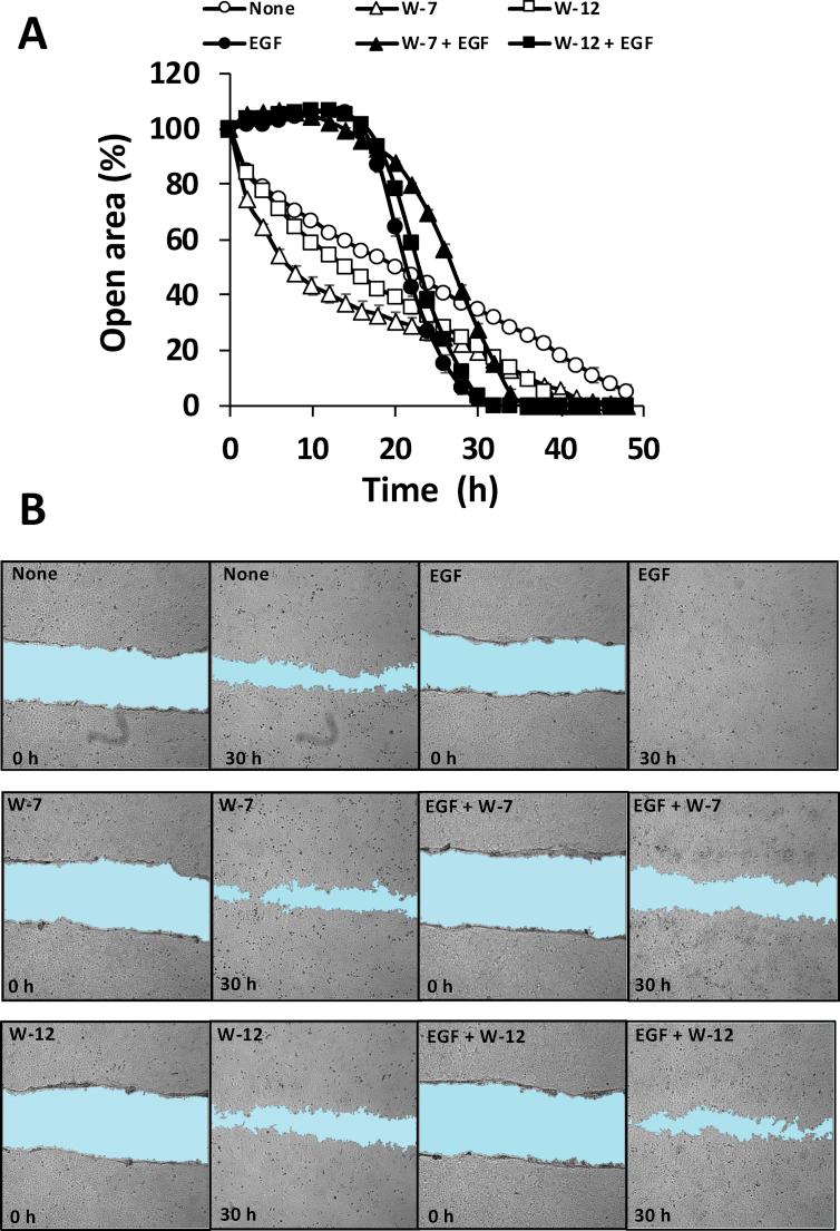 https://cdn.ncbi.nlm.nih.gov/pmc/blobs/2761/7215194/34dbf9cc2028/gr5.jpg