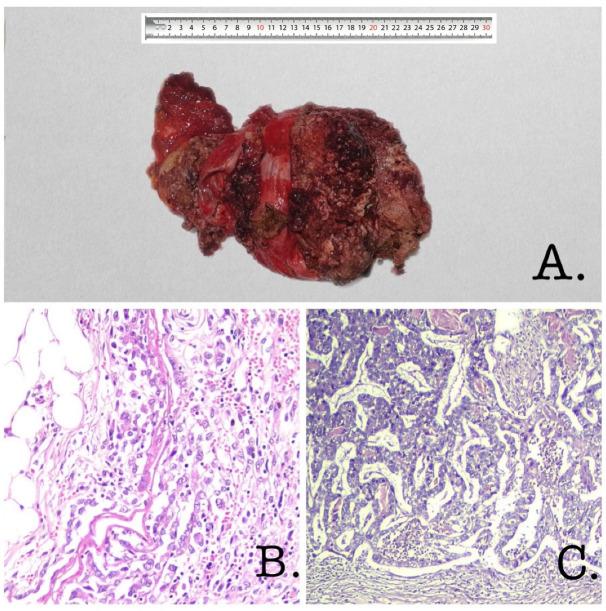 https://cdn.ncbi.nlm.nih.gov/pmc/blobs/2762/9857600/b5e7a5676b15/diagnostics-13-00194-g003.jpg