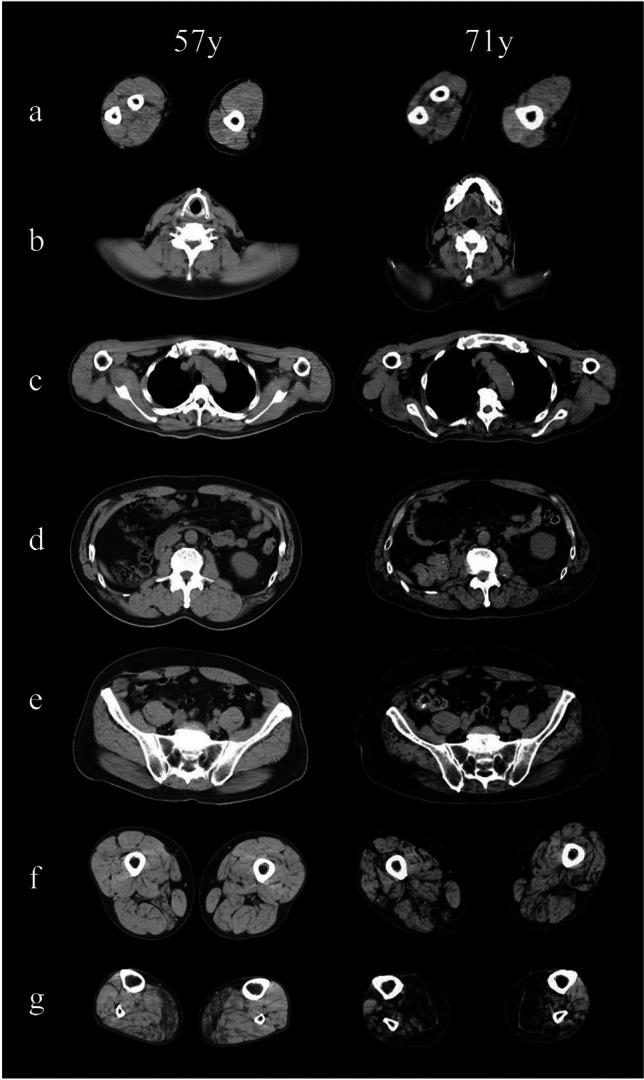 https://cdn.ncbi.nlm.nih.gov/pmc/blobs/2766/11269323/cb6254221cd4/12311_2024_1666_Fig2_HTML.jpg