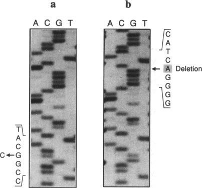 https://cdn.ncbi.nlm.nih.gov/pmc/blobs/276c/1801309/3c73994a7c1f/ajhg00027-0179-a.jpg