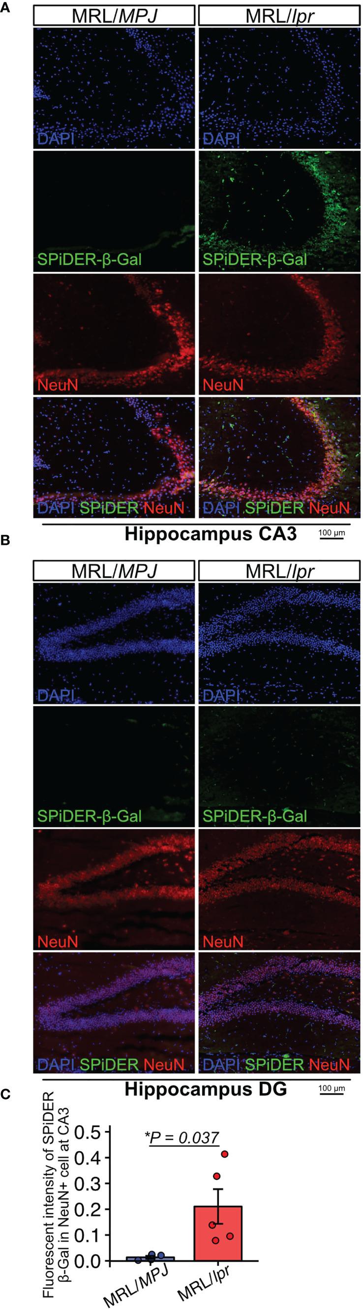 https://cdn.ncbi.nlm.nih.gov/pmc/blobs/2775/8597709/c2c00d83e19e/fimmu-12-692321-g002.jpg