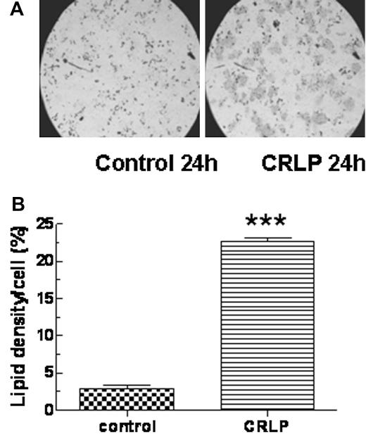 https://cdn.ncbi.nlm.nih.gov/pmc/blobs/2779/3212651/e964e0ba5445/gr1.jpg