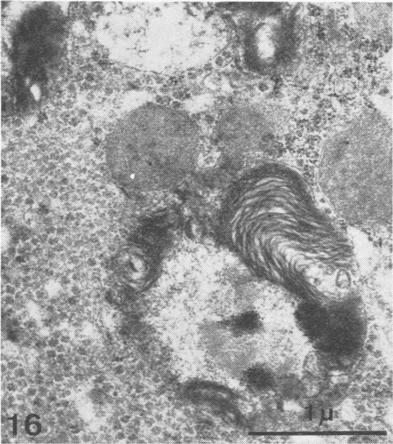 https://cdn.ncbi.nlm.nih.gov/pmc/blobs/277e/1347205/0ac32a0967e5/jclinpath00436-0088-b.jpg