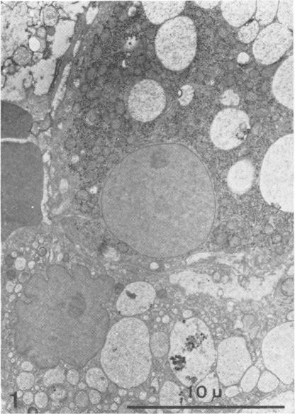 https://cdn.ncbi.nlm.nih.gov/pmc/blobs/277e/1347205/fc010eb50d9d/jclinpath00436-0070-a.jpg