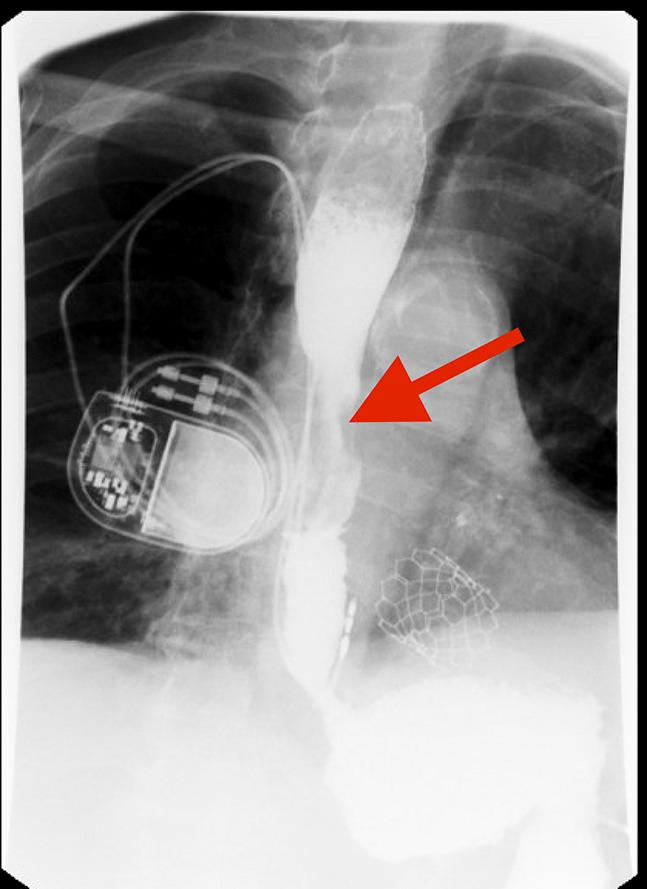 https://cdn.ncbi.nlm.nih.gov/pmc/blobs/2783/12055172/c5cebae68321/ac9-12-e01693-g001.jpg
