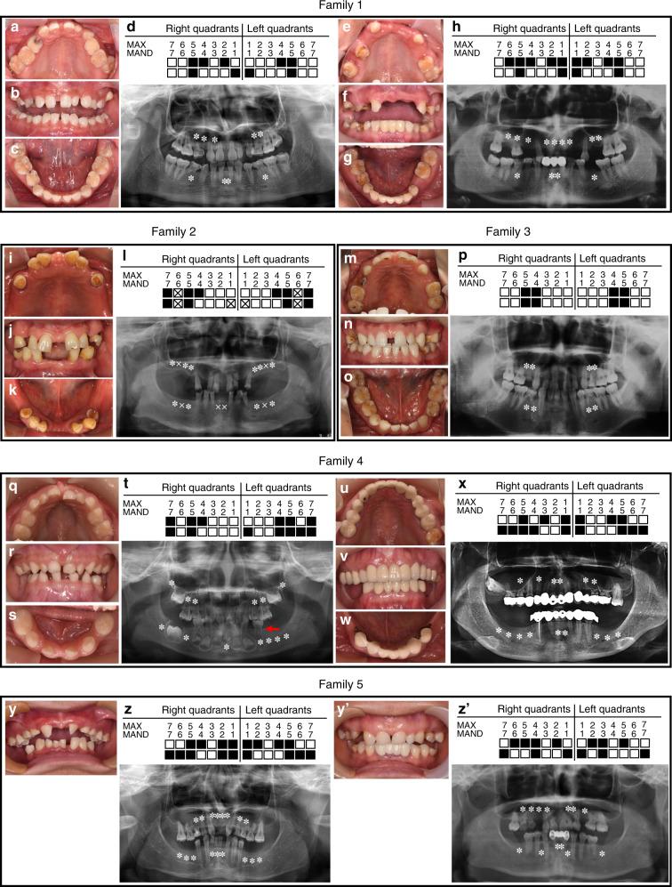 https://cdn.ncbi.nlm.nih.gov/pmc/blobs/2783/7794556/15cec7a9d52c/41368_2020_106_Fig1_HTML.jpg